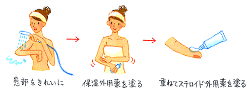 �X�e���C�h�O�p��̓h���